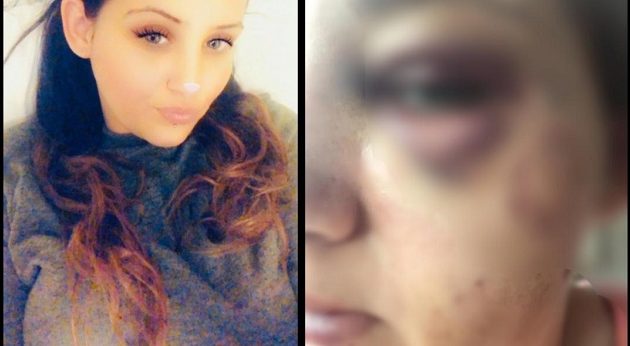 Εφιάλτης για 26χρονη: Την έκαψε με τσιγάρο, την έλουσε με χλωρίνη και τη μαχαίρωσε γιατί ζήλευε