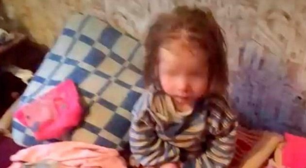 7χρονη βρέθηκε πεινασμένη και σκελετωμένη – Κρατείται η θετή μάνα