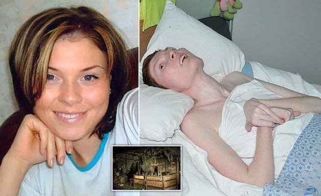 Πέθανε 44χρονη μετά από 11 χρόνια που είχε καταστραφεί ο εγκέφαλος της σε πυρκαγιά
