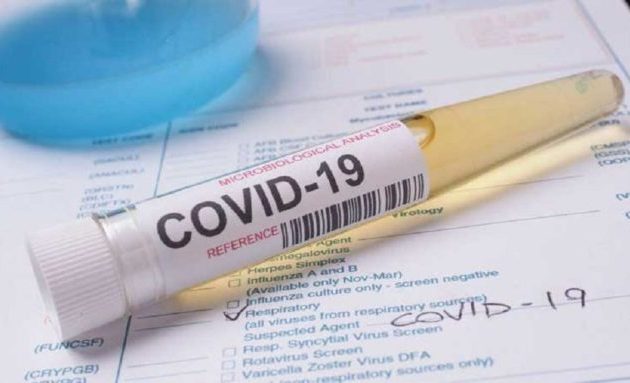 Κορωνοϊός: Ξεφεύγει η κατάσταση στην Αττική με 141 από τα 284 κρούσματα την Κυριακή