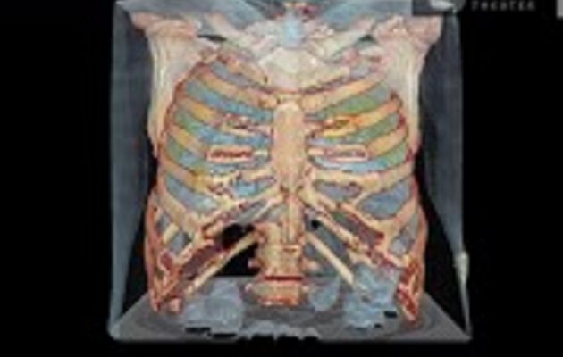 New York Times: Πώς ο κορωνοϊός επιτίθεται στον ανθρώπινο οργανισμό (βίντεο)