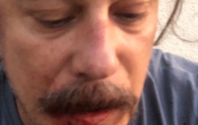 Αυτοεξόριστος Τούρκος δημοσιογράφος δέχθηκε άγρια επίθεση μέσα στο σπίτι του στο Βερολίνο