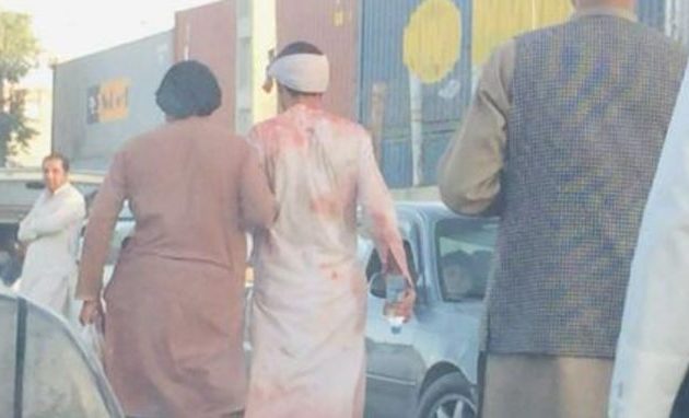 Βομβιστική επίθεση Καμπούλ: Δεν υπάρχουν Έλληνες μεταξύ των θυμάτων ή Αφγανοί πολίτες ελληνικού ενδιαφέροντος