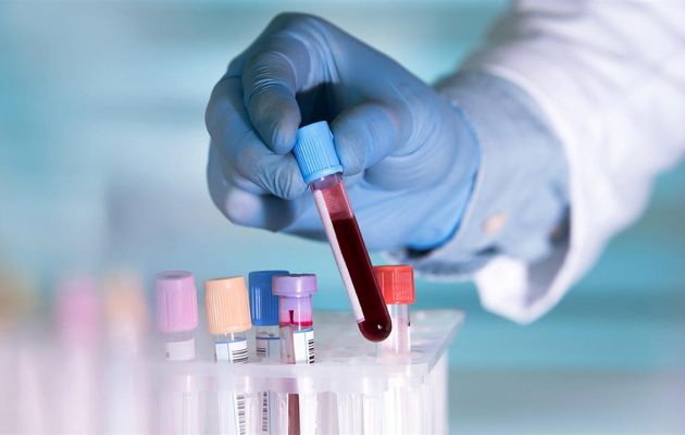 Νέο τεστ αίματος μπορεί να προβλέψει την πιθανότητα σοβαρής Covid-19