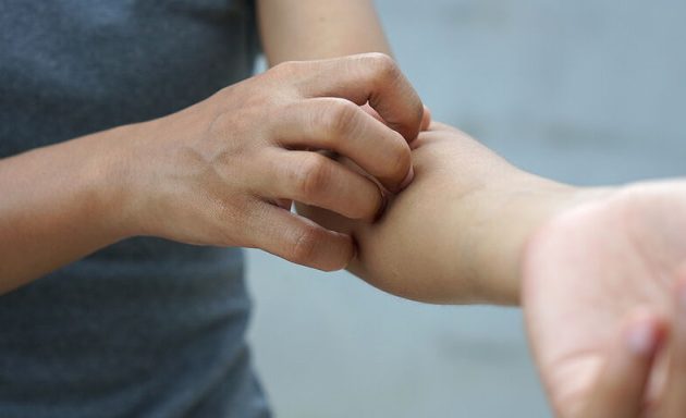 Δερματικό σύμπτωμα προκαλεί η Όμικρον – Τι έδειξε νέα μελέτη