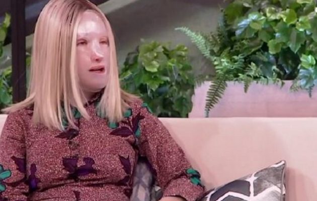 Τι είπε ο ψυχίατρος της Ιωάννας Παλιοσπύρου για την επίθεση με το βιτριόλι