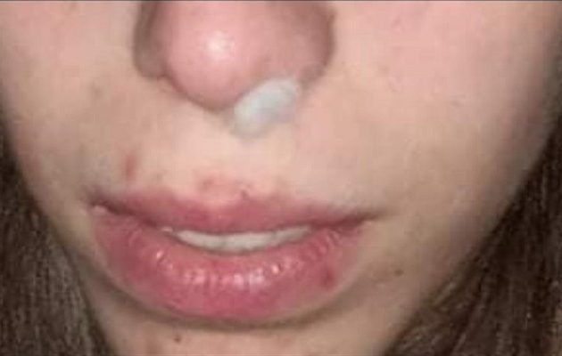Ηράκλειο: Νεαρή φοιτήτρια ακινητοποίησε κλέφτη που επιτέθηκε στη φίλη της