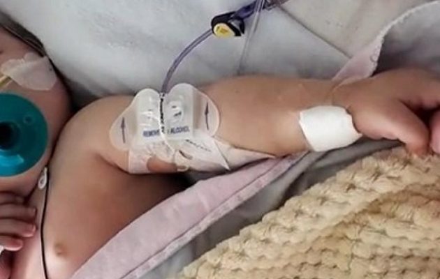 Βραζιλία: Γεννήθηκε αγοράκι με δύο πέη – Χειρουργοί του ακρωτηρίασαν το μεγαλύτερο