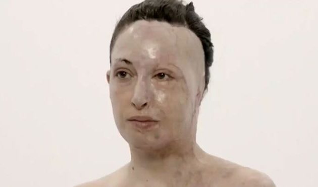 Επίθεση με βιτριόλι: Η Ιωάννα Παλιοσπύρου έβγαλε τη μάσκα (φωτο)