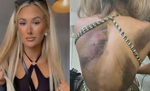 Λονδίνο: 21χρονη κουκλάρα νοσοκόμα έπεσε στις γραμμές του Μετρό και ψάχνει τον άνδρα που την έσωσε