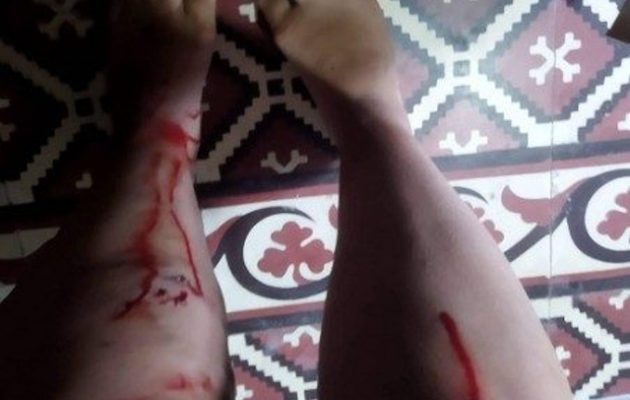 Βόλος: Σε ασφαλή χώρο η 26χρονη που απειλήθηκε με κατσαβίδι από 34χρονο