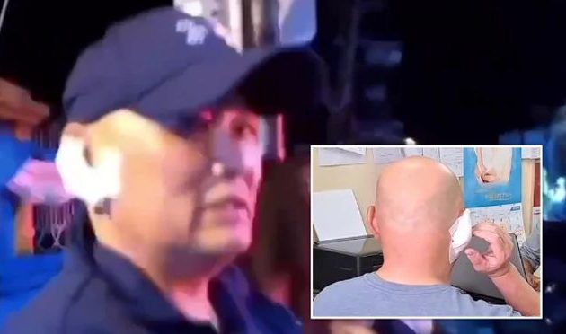 Μεθυσμένη ιερόδουλη δάγκωσε, έκοψε και κατάπιε αμάσητο λοβό αυτιού ενός τουρίστα