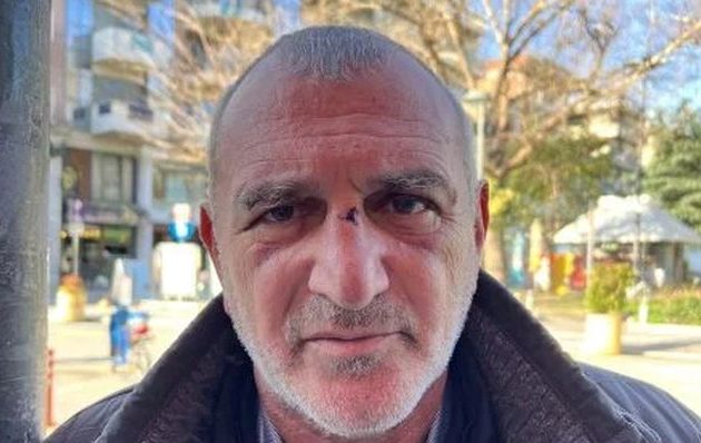 Επιβάτης Τέμπη: Οι συνεπιβάτες μου εξαϋλώθηκαν