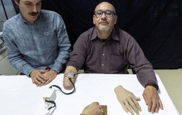 Βιονικό προσθετικό χέρι νιώθει τη ζεστασιά της ανθρώπινης επαφής (βίντεο)