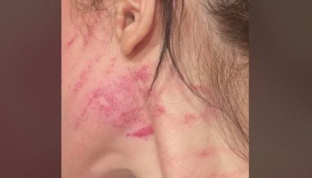 Ζήτησε από τον σύντροφό της να χωρίσουν κι από τότε όπου τη βρίσκει την δέρνει