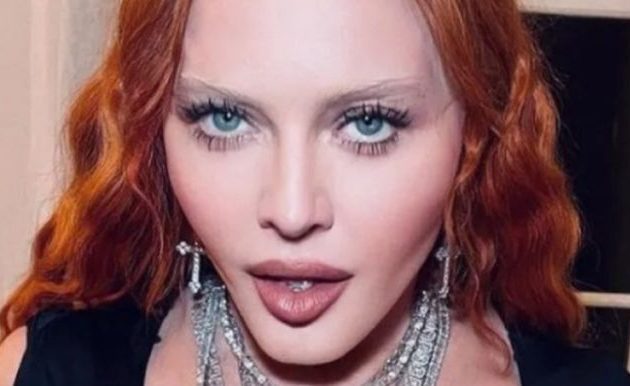 Η Μαντόνα «αναρρώνει στο σπίτι της, είναι πολύ δυνατή σε γενικές γραμμές» – Είχε μπει σε ΜΕΘ