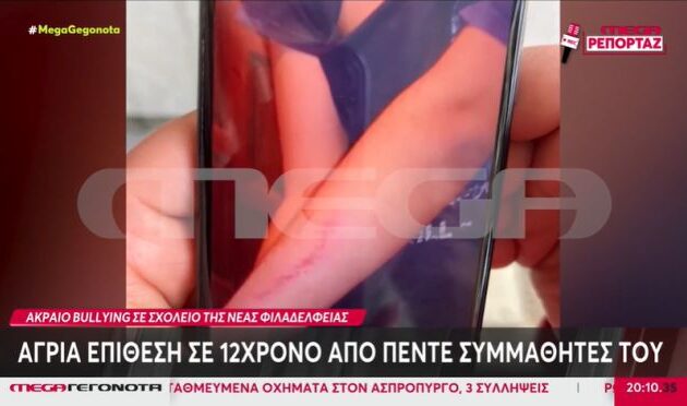 Έχει ξεφύγει η βία ανηλίκων! Ξυλοδαρμός 12χρονου από συμμαθητές του σε δημοτικό σχολείο στη Νέα Φιλαδέλφεια