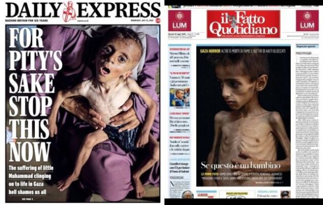 Οι ΨΕΥΤΕΣ έδειξαν παιδιά που πάσχουν από γενετικές ασθένειες και εκφυλιστικές νόσους ως δήθεν θύματα λιμού στη Γάζα