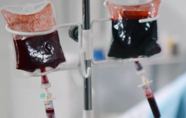 Λάθος μετάγγιση αίματος σε 67χρονο σε ιδιωτική κλινική της Αθήνας – Αδ. Γεωργιάδης: «Aυτά είναι περιστατικά που μπορεί να συμβούν»