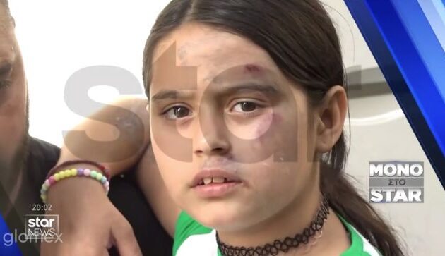 Σεπόλια: Γυναίκα οδηγός αποπειράθηκε να αρπάξει 9χρονο κορίτσι – Την έσυρε αρκετά μέτρα